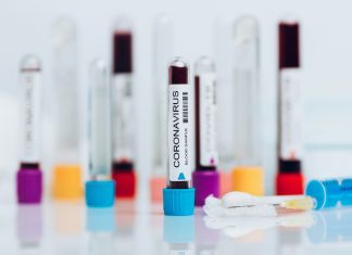 Bishop Burbidge: The pandemic is our ‘Pentecost moment’